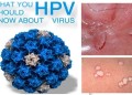 HPV là virus gì
