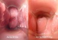 Dấu hiệu viêm âm đạo ở nữ giới sớm 